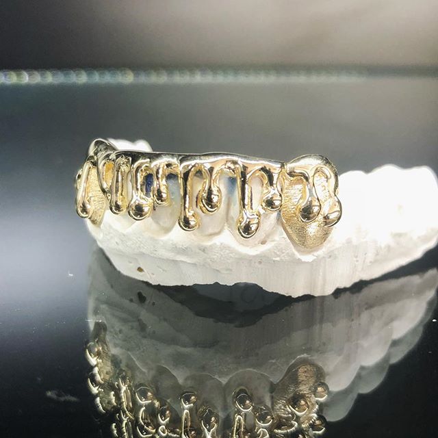 6 Teeth Gold Grillz - 6 Bottoms (Open Face Drip)