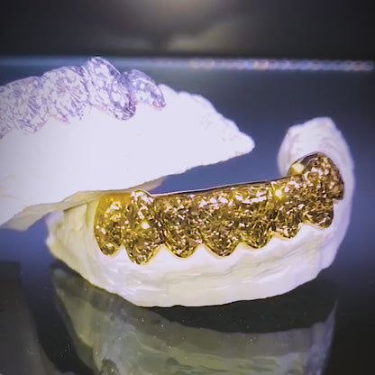 8 Teeth Gold Grillz - 8 Tops or Bottoms (Starburst w/Trillion Cut)